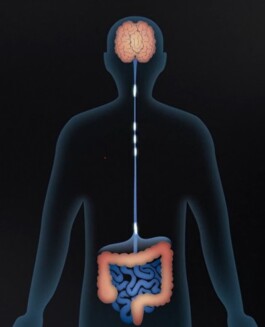 FEI-projet-apra-4 fsei
